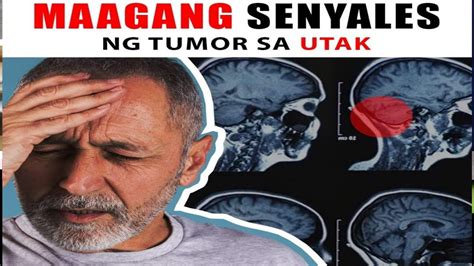 sintomas ng tumor sa panga